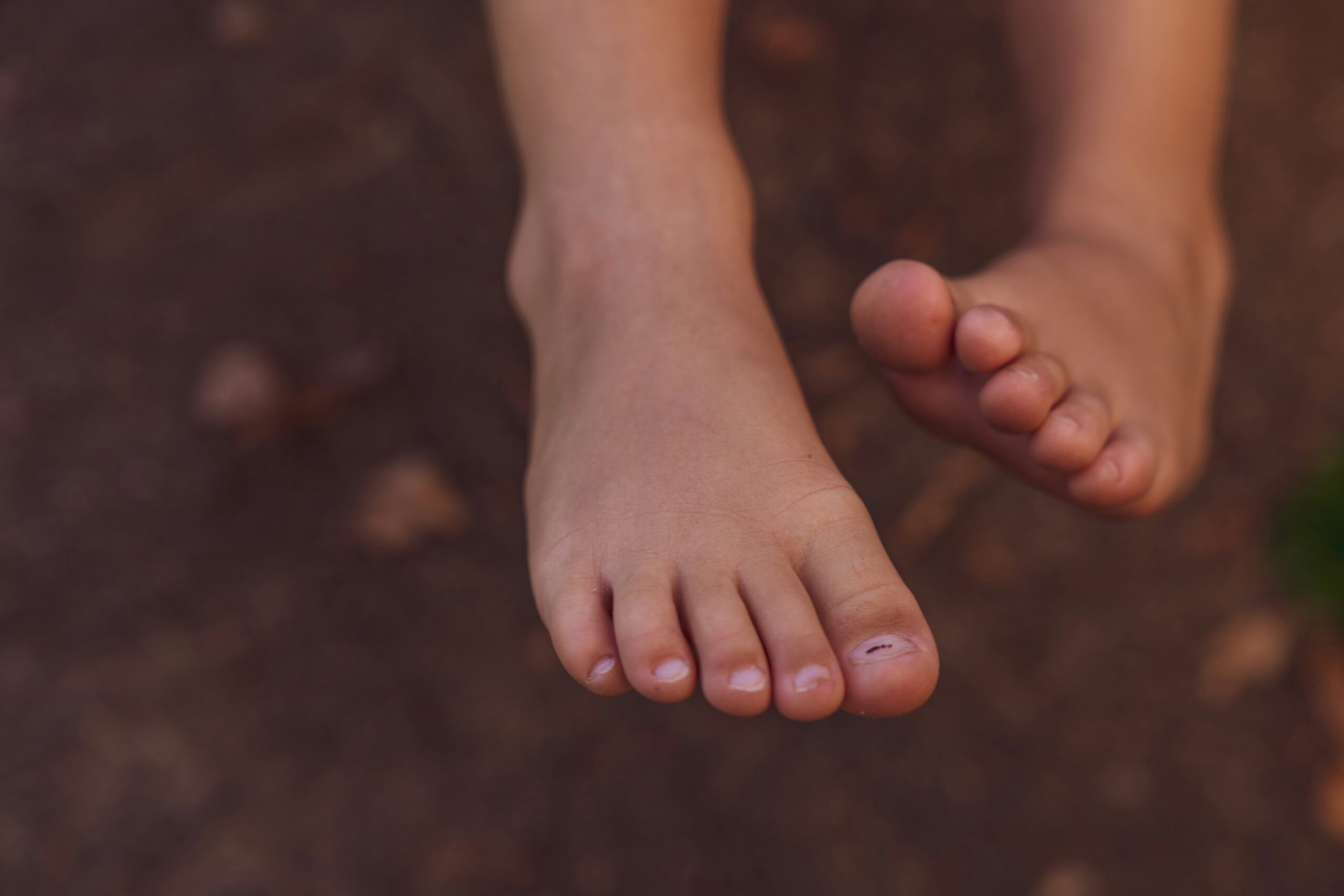 How Do I Know If My Toe Is Broken or Just Bruised? Signs, Symptoms, and What to Do Next